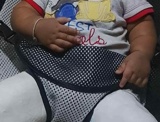 သံတွဲမြို့က လသားအရွယ် ကလေးငယ်တစ်ဦး ကော့စမွီဆေးရုံမှာဆေးကုသခံနေရပြီး အသက်ရှင်ရေး အတွက် အကူအညီလိုအပ်နေ